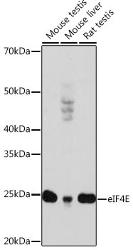 eIF4E Rabbit Monoclonal Antibody
