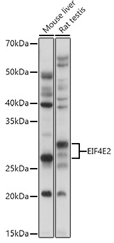 EIF4E2 Rabbit Polyclonal Antibody - Image 2