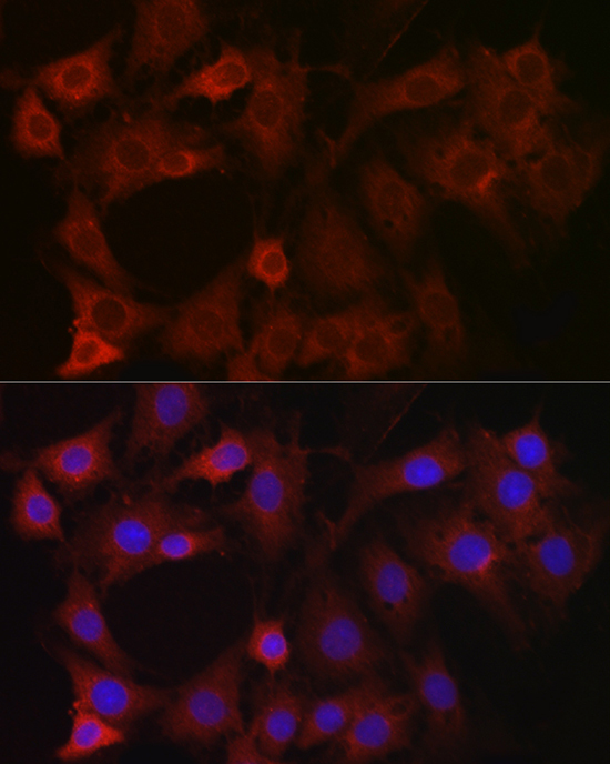 EIF4E2 Rabbit Polyclonal Antibody - Image 3