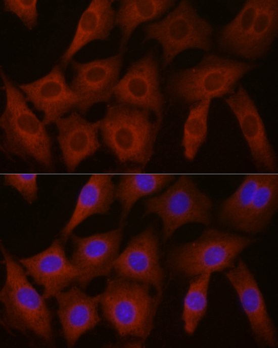 EIF4E2 Rabbit Polyclonal Antibody - Image 4