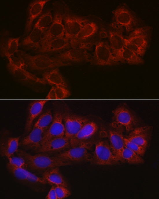 EIF4E2 Rabbit Polyclonal Antibody - Image 5