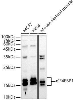 eIF4EBP1 Rabbit Polyclonal Antibody