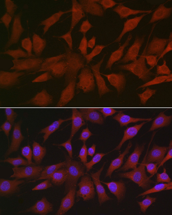 EIF4ENIF1 Rabbit Polyclonal Antibody - Image 2