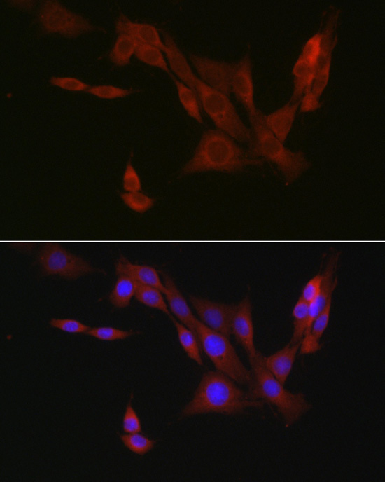 EIF4ENIF1 Rabbit Polyclonal Antibody - Image 3