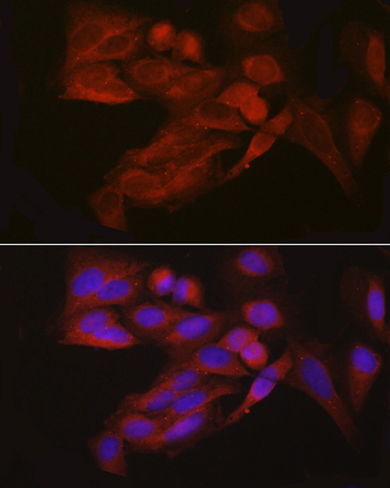 EIF4ENIF1 Rabbit Polyclonal Antibody - Image 4