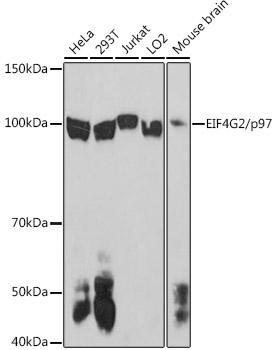 EIF4G2/p97 Rabbit Polyclonal Antibody