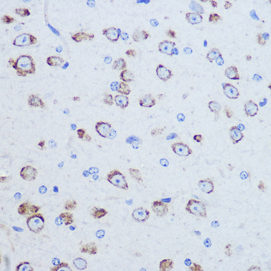 EIF4G2/p97 Rabbit Polyclonal Antibody - Image 2
