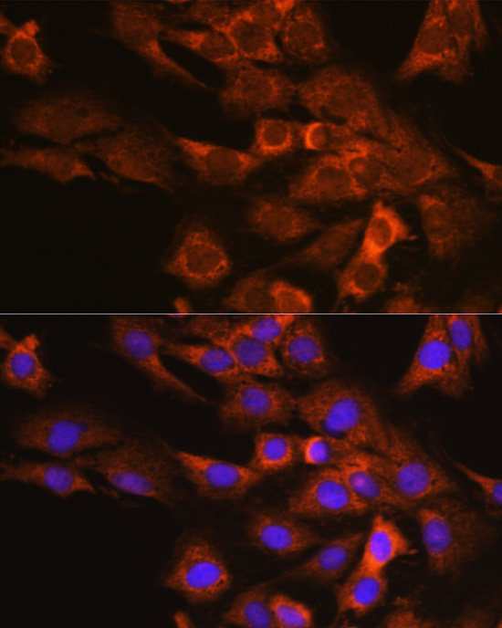 EIF4G2/p97 Rabbit Polyclonal Antibody - Image 3