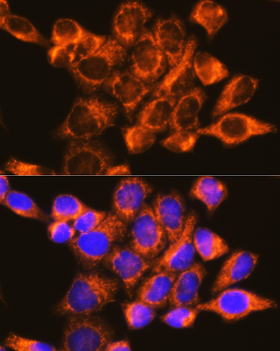 EIF4G2/p97 Rabbit Polyclonal Antibody - Image 4