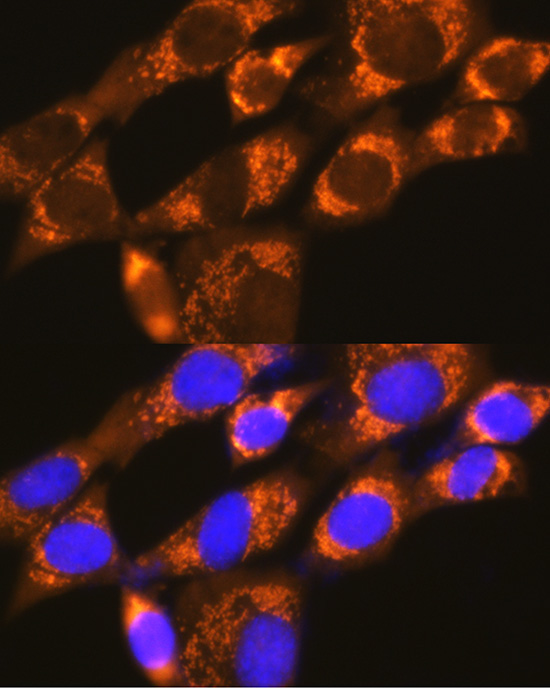 EIF4G2/p97 Rabbit Polyclonal Antibody - Image 5