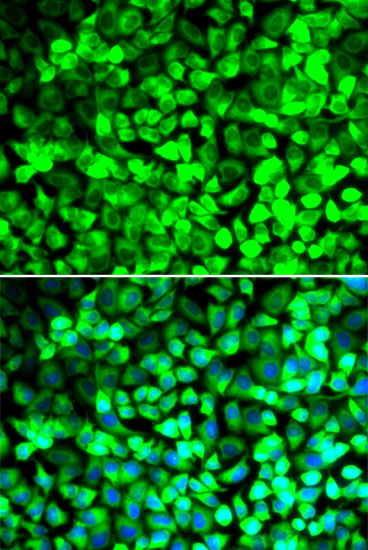 EIF5 Rabbit Polyclonal Antibody - Image 2