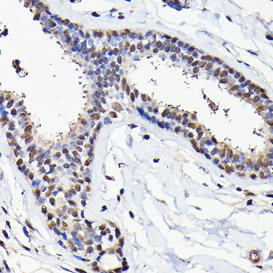 eIF5A Rabbit Polyclonal Antibody - Image 2
