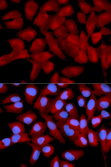 eIF5A Rabbit Polyclonal Antibody - Image 3