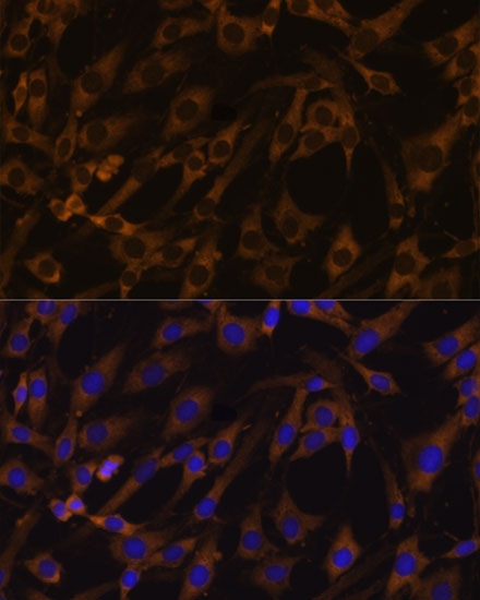 EIF5B Rabbit Polyclonal Antibody - Image 2