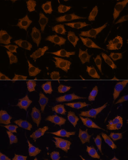 EIF5B Rabbit Polyclonal Antibody - Image 3