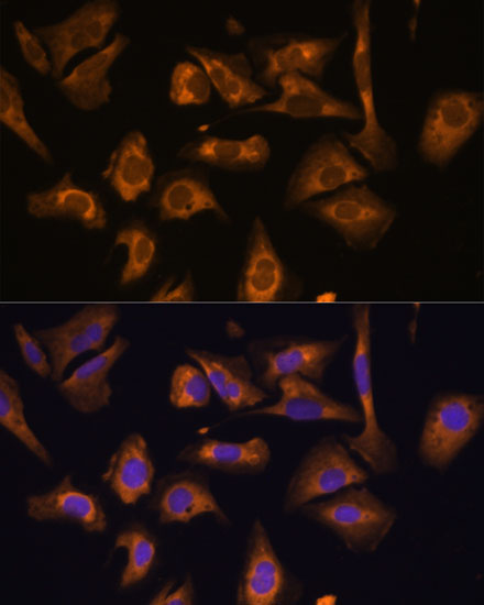 EIF5B Rabbit Polyclonal Antibody - Image 4