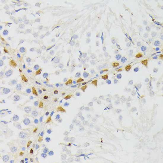 ELAC2 Rabbit Polyclonal Antibody - Image 2