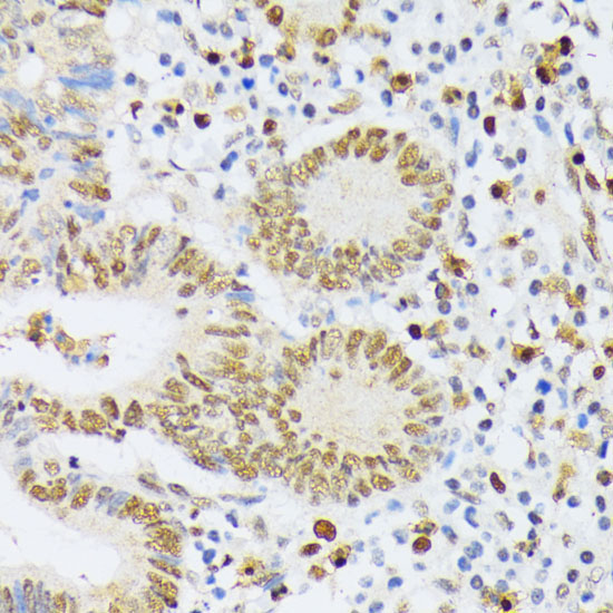 ELAC2 Rabbit Polyclonal Antibody - Image 3
