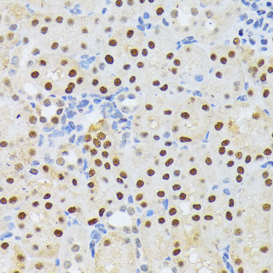 ELAC2 Rabbit Polyclonal Antibody - Image 4