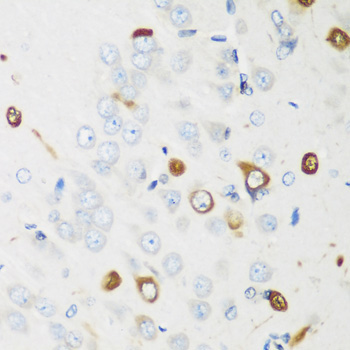 ELAVL2 Rabbit Polyclonal Antibody - Image 2