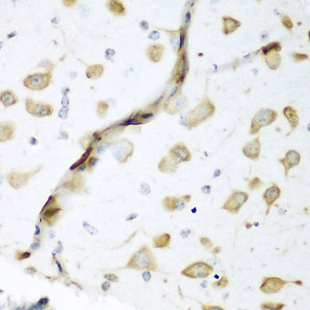 ELAVL2 Rabbit Polyclonal Antibody - Image 3