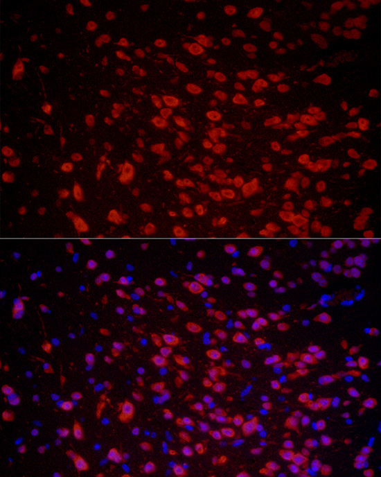 ELAVL3 Rabbit Polyclonal Antibody - Image 2