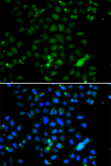 ELF4 Rabbit Polyclonal Antibody