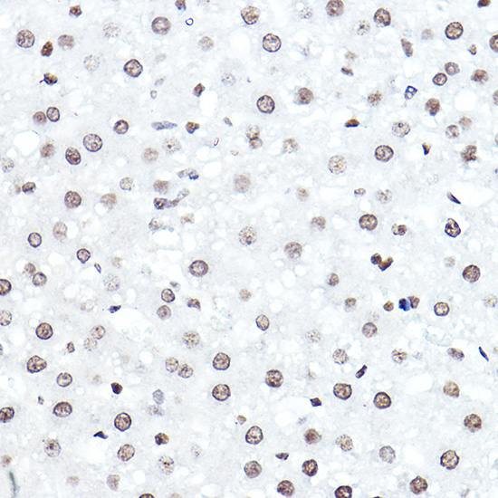 ELF5 Rabbit Polyclonal Antibody - Image 2