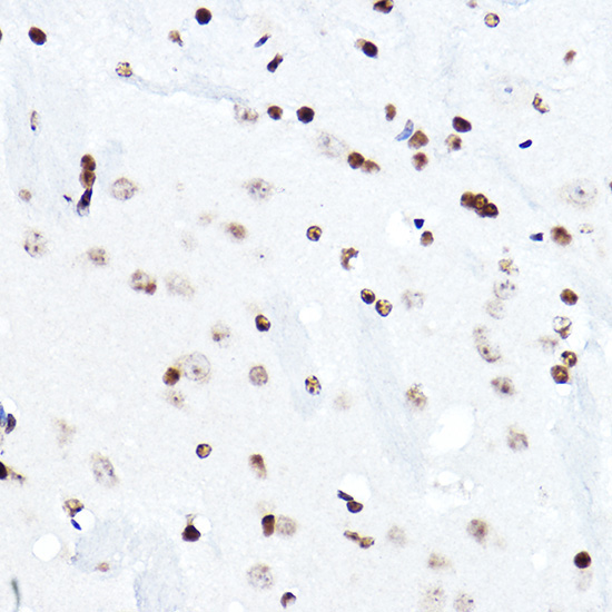 ELF5 Rabbit Polyclonal Antibody - Image 3