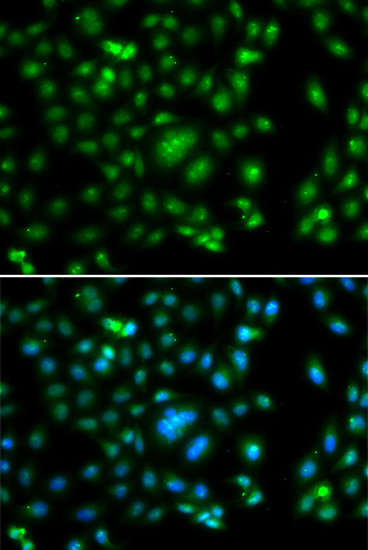 ELF5 Rabbit Polyclonal Antibody - Image 4