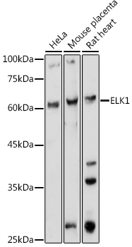 ELK1 Rabbit Polyclonal Antibody