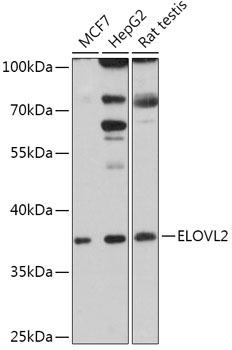 ELOVL2 Rabbit Polyclonal Antibody