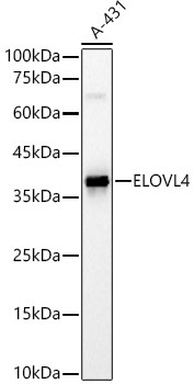ELOVL4 Rabbit Polyclonal Antibody