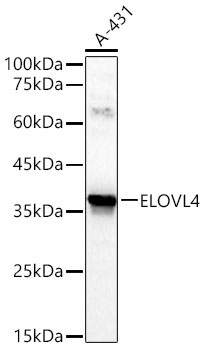 ELOVL4 Rabbit Polyclonal Antibody - Image 2