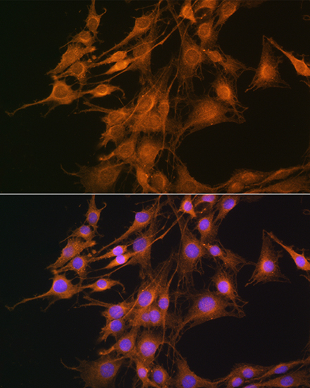 ELOVL4 Rabbit Polyclonal Antibody - Image 3