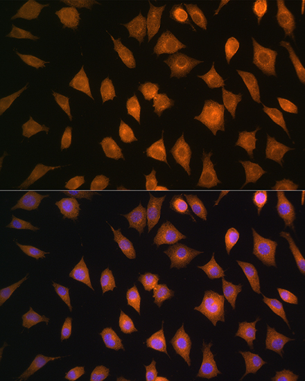 ELOVL4 Rabbit Polyclonal Antibody - Image 4