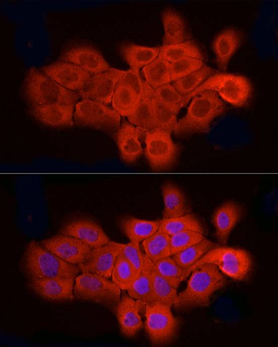 ELOVL4 Rabbit Polyclonal Antibody - Image 5