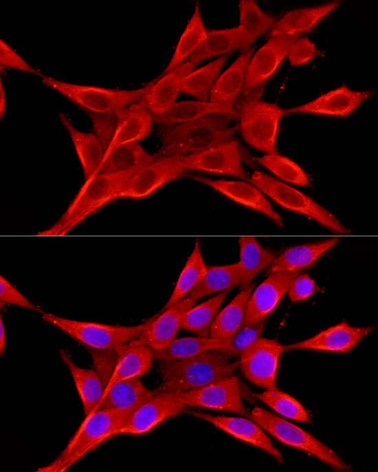 ELOVL4 Rabbit Polyclonal Antibody - Image 6