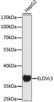 ELOVL5 Rabbit Polyclonal Antibody