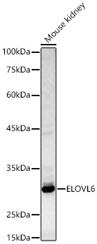 ELOVL6 Rabbit Polyclonal Antibody