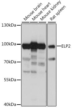 ELP2 Rabbit Polyclonal Antibody