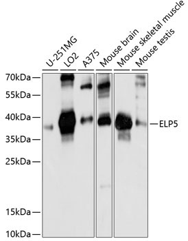 ELP5 Rabbit Polyclonal Antibody