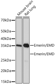 Emerin/EMD Rabbit Monoclonal Antibody