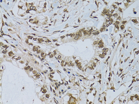 Emerin/EMD Rabbit Polyclonal Antibody - Image 2