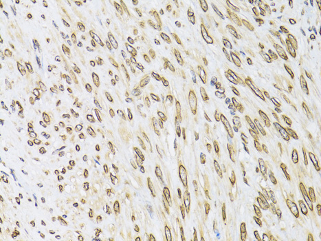Emerin/EMD Rabbit Polyclonal Antibody - Image 3