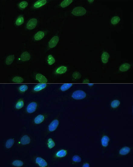 Emerin/EMD Rabbit Polyclonal Antibody - Image 4