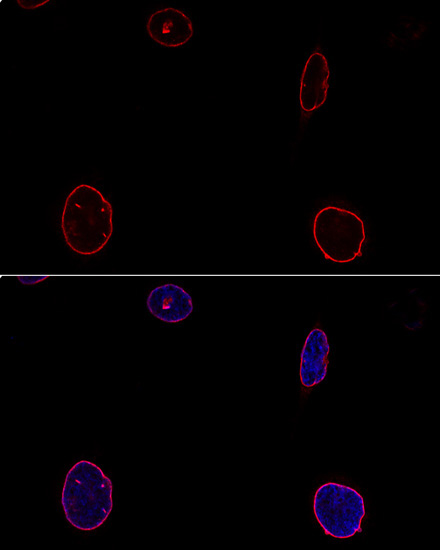 Emerin/EMD Rabbit Polyclonal Antibody - Image 5