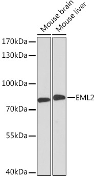 EML2 Rabbit Polyclonal Antibody
