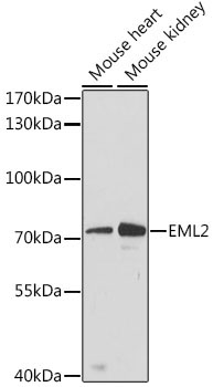 EML2 Rabbit Polyclonal Antibody