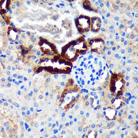 EML4 Rabbit Polyclonal Antibody - Image 2
